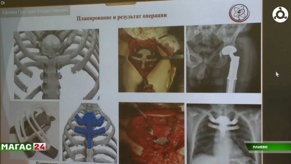 В Онкодиспансере Ингушетии прошел второй день мастер-класса от онкологов из Москвы