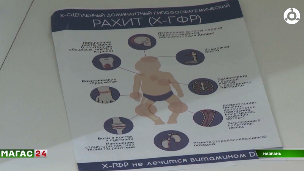 Редкие детки: как в Ингушетии помогают малышам с орфанными заболеваниями