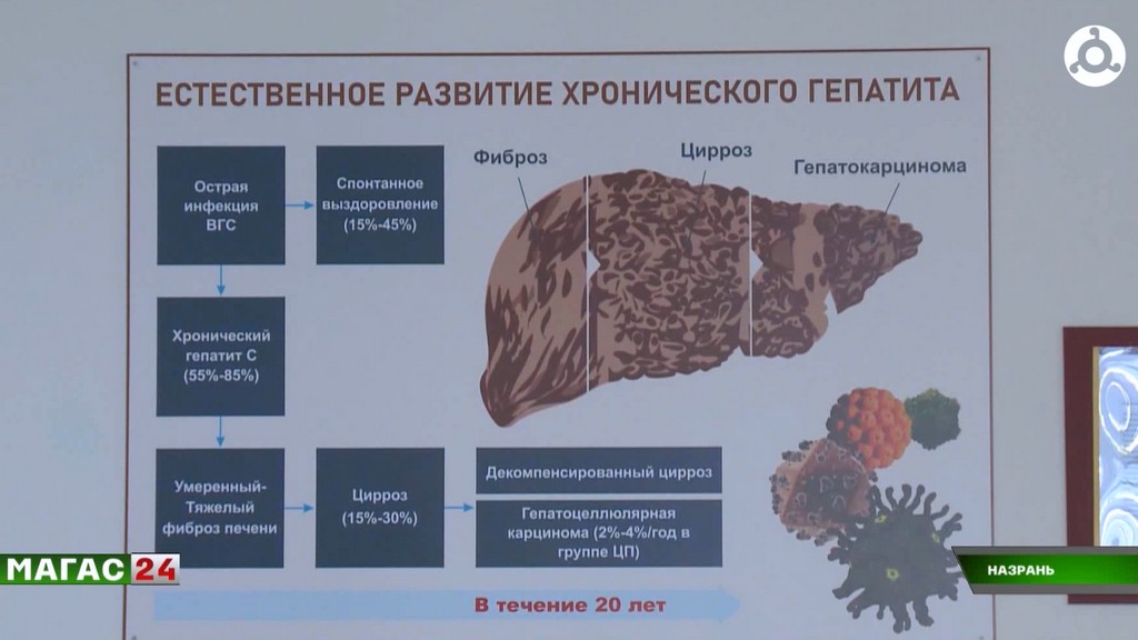 Гепатит сегодня — не приговор: в Ингушетии наступают на болезнь современной диагностикой и лечением